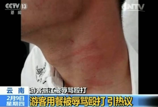 游客麗江就餐被辱罵毆打 真相到底是什么？